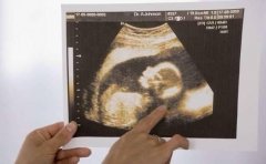 女性选择在广州助孕中心胚胎冷冻有什么好处?