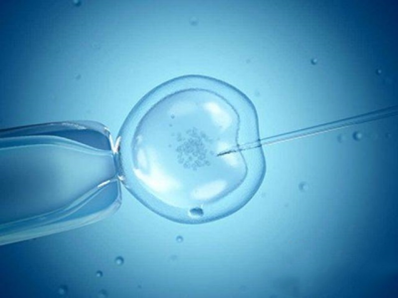 大龄女性做试管助孕，需特别注意的4件事！