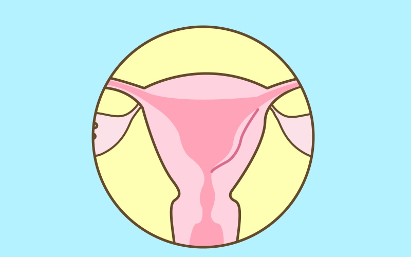 姐妹们，这4个信号提示我们子宫可能生病了！