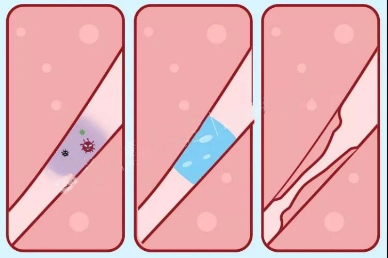 输卵管积水，还能做试管吗？