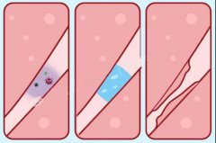 输卵管积水，还能做试管吗？